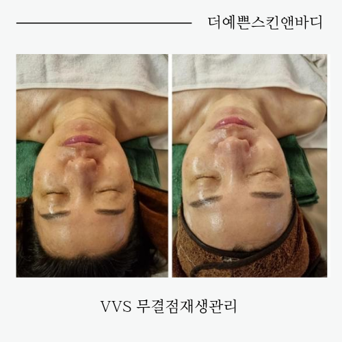 더예쁜스킨앤바디