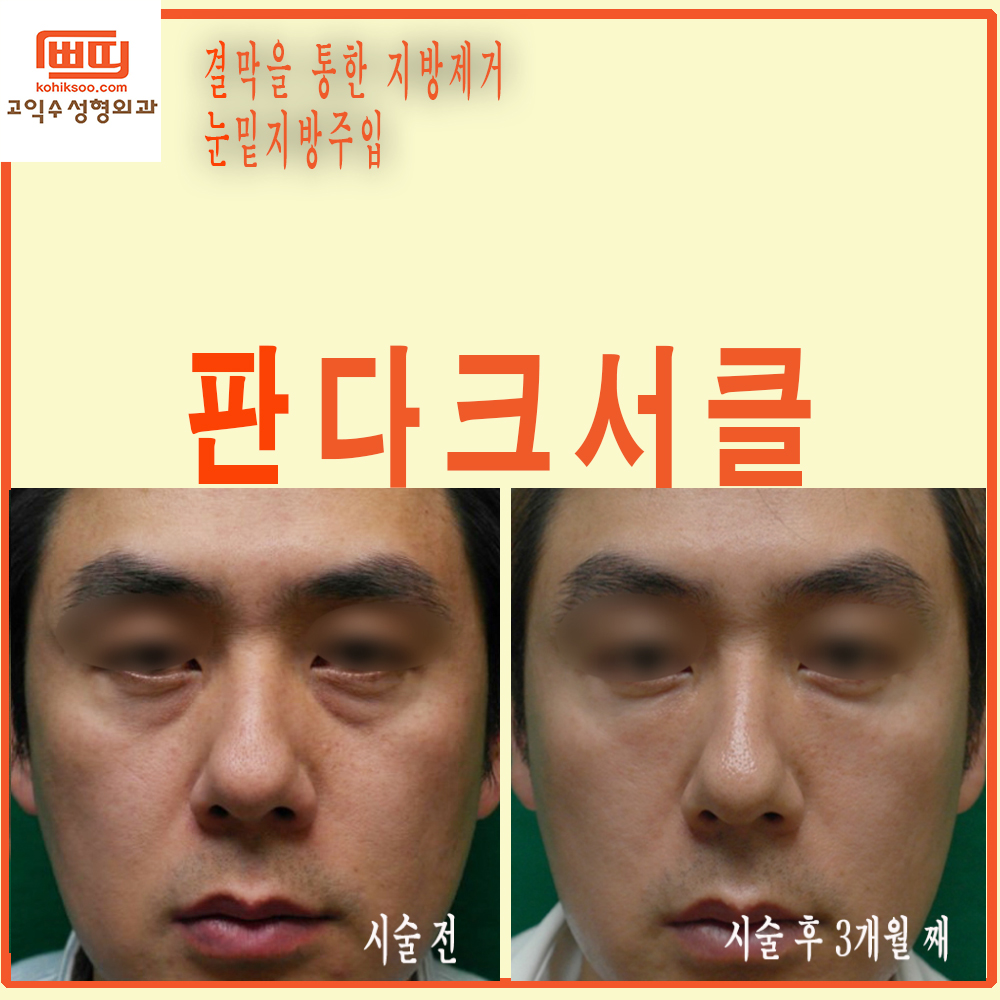 고익수성형외과의원 대표 이미지