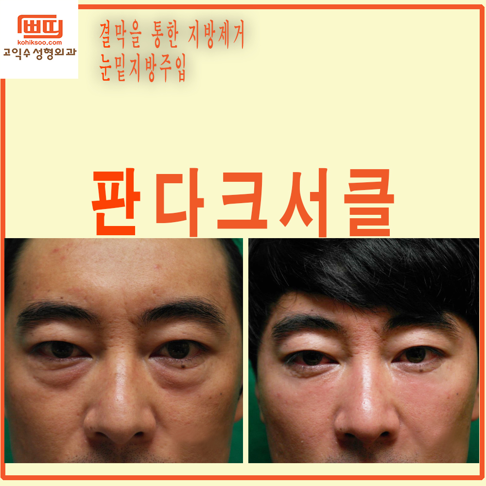 고익수성형외과의원 대표 이미지