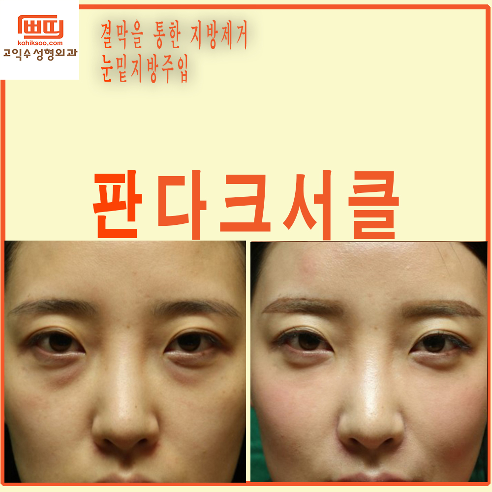 고익수성형외과의원 대표 이미지