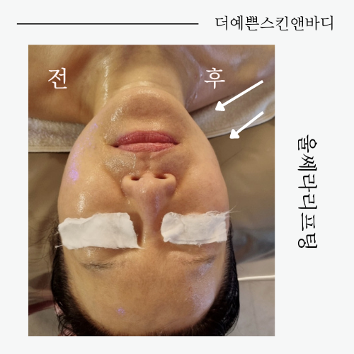 더예쁜스킨앤바디