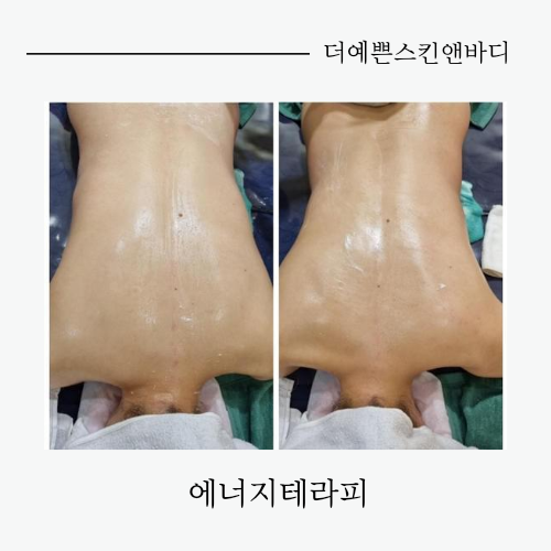 더예쁜스킨앤바디