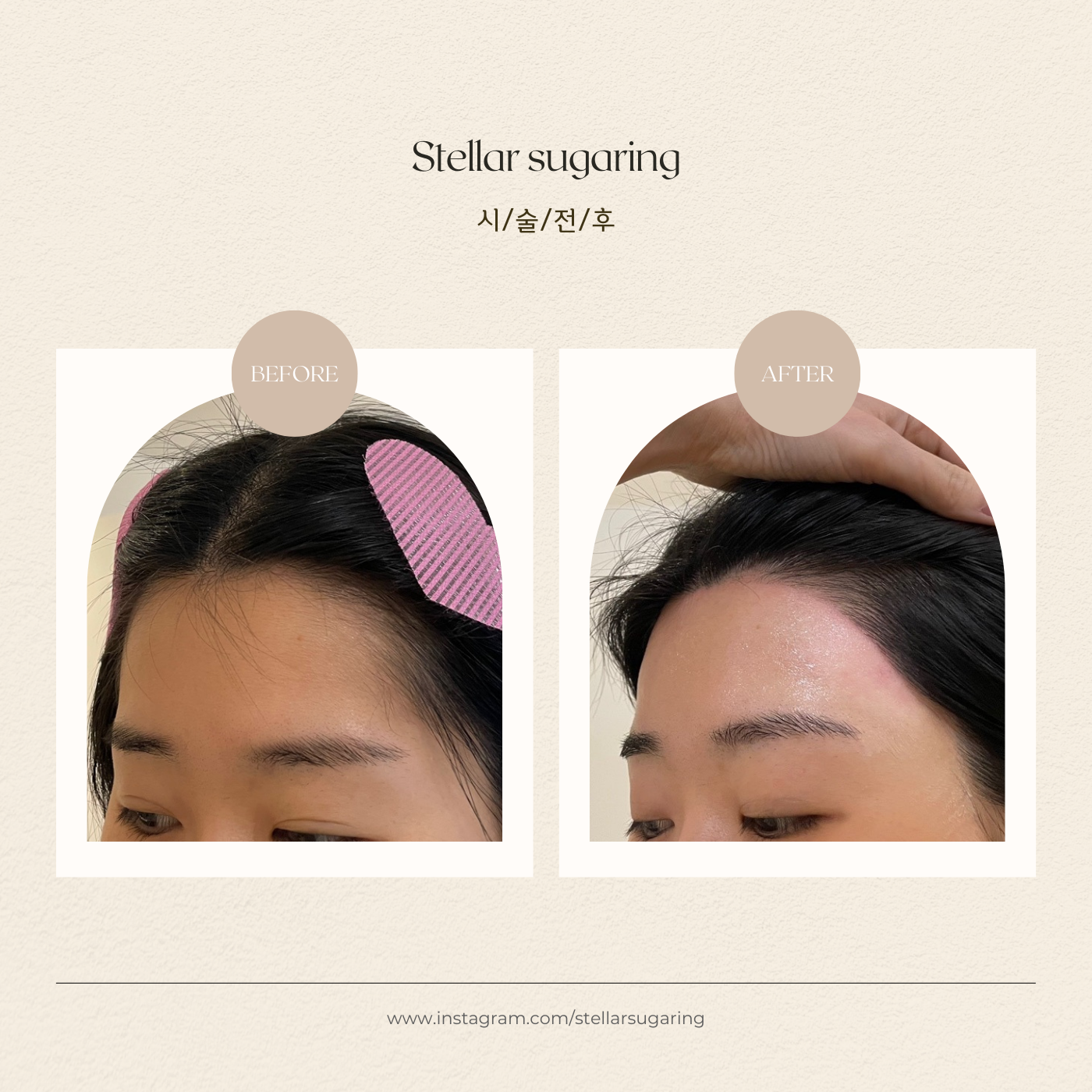 스텔라슈가링 구월동왁싱