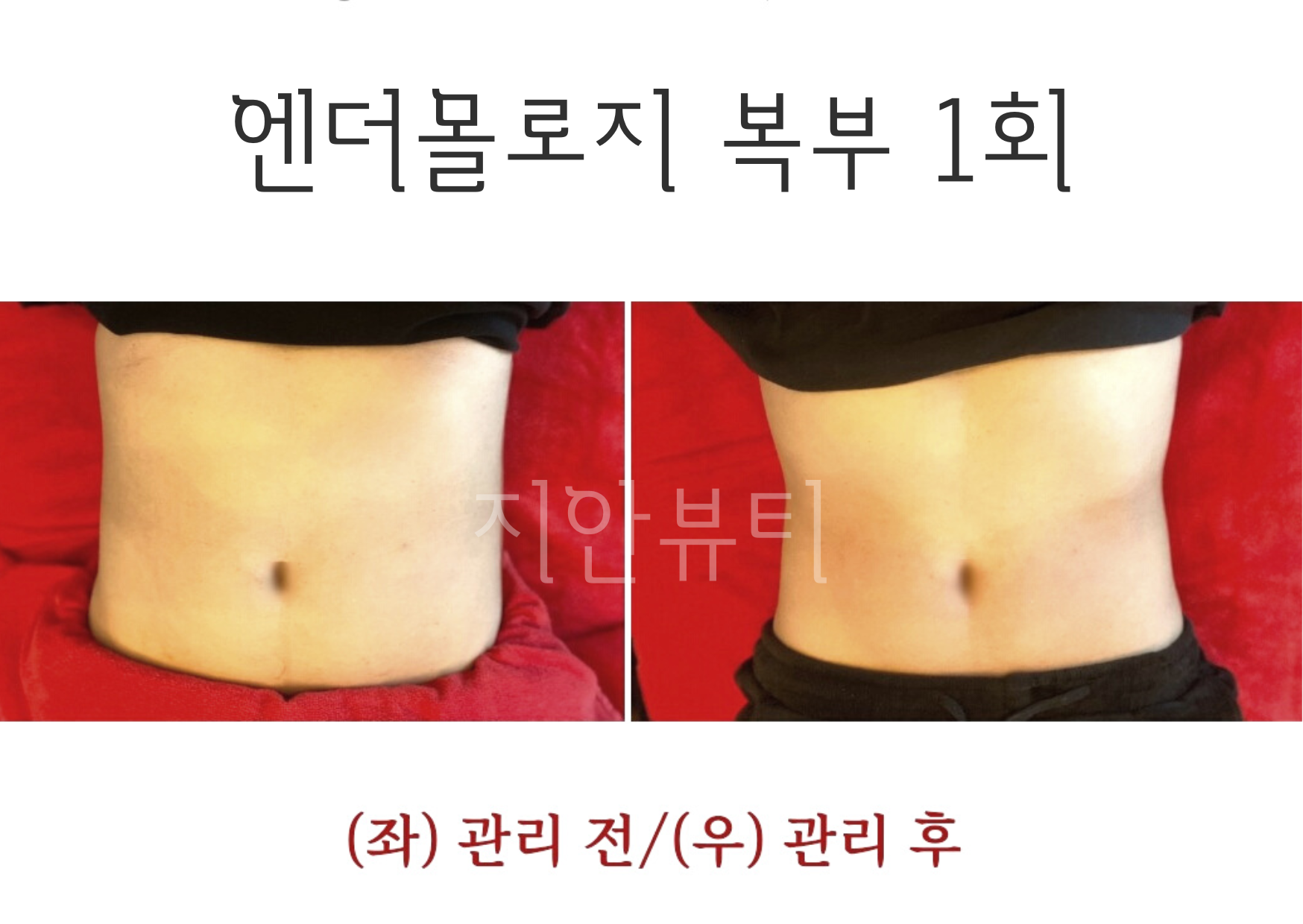 지안뷰티 photo 5