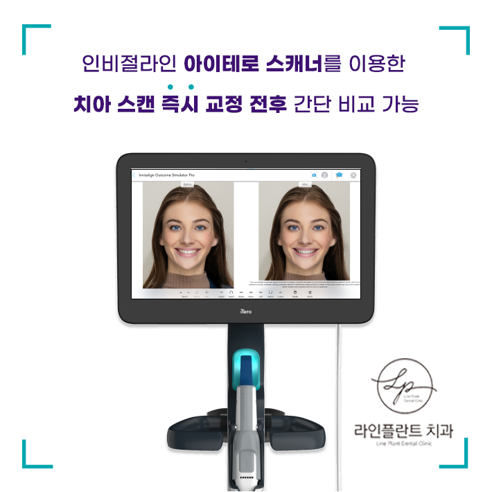라인플란트치과의원 대표 이미지