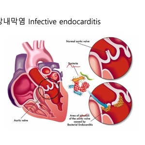 힐링파크