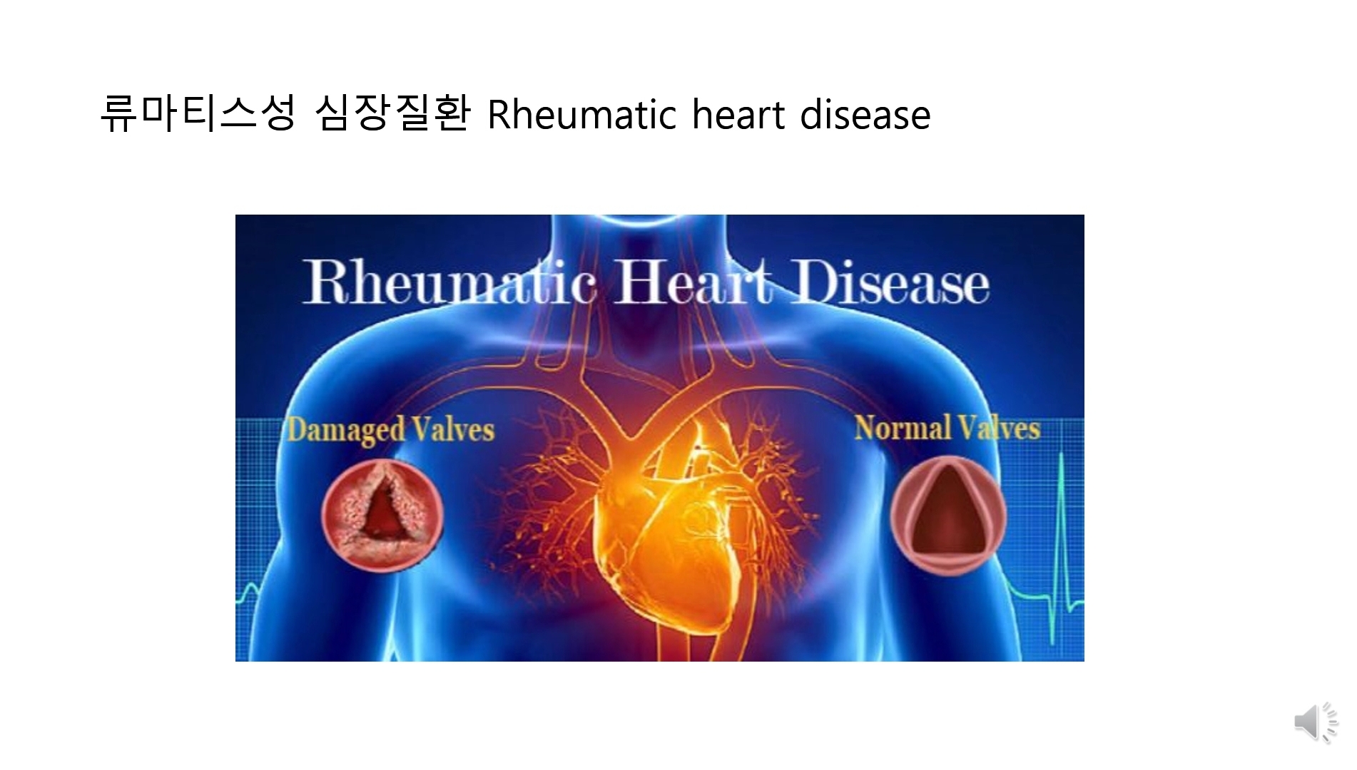 힐링파크 건강만들기
