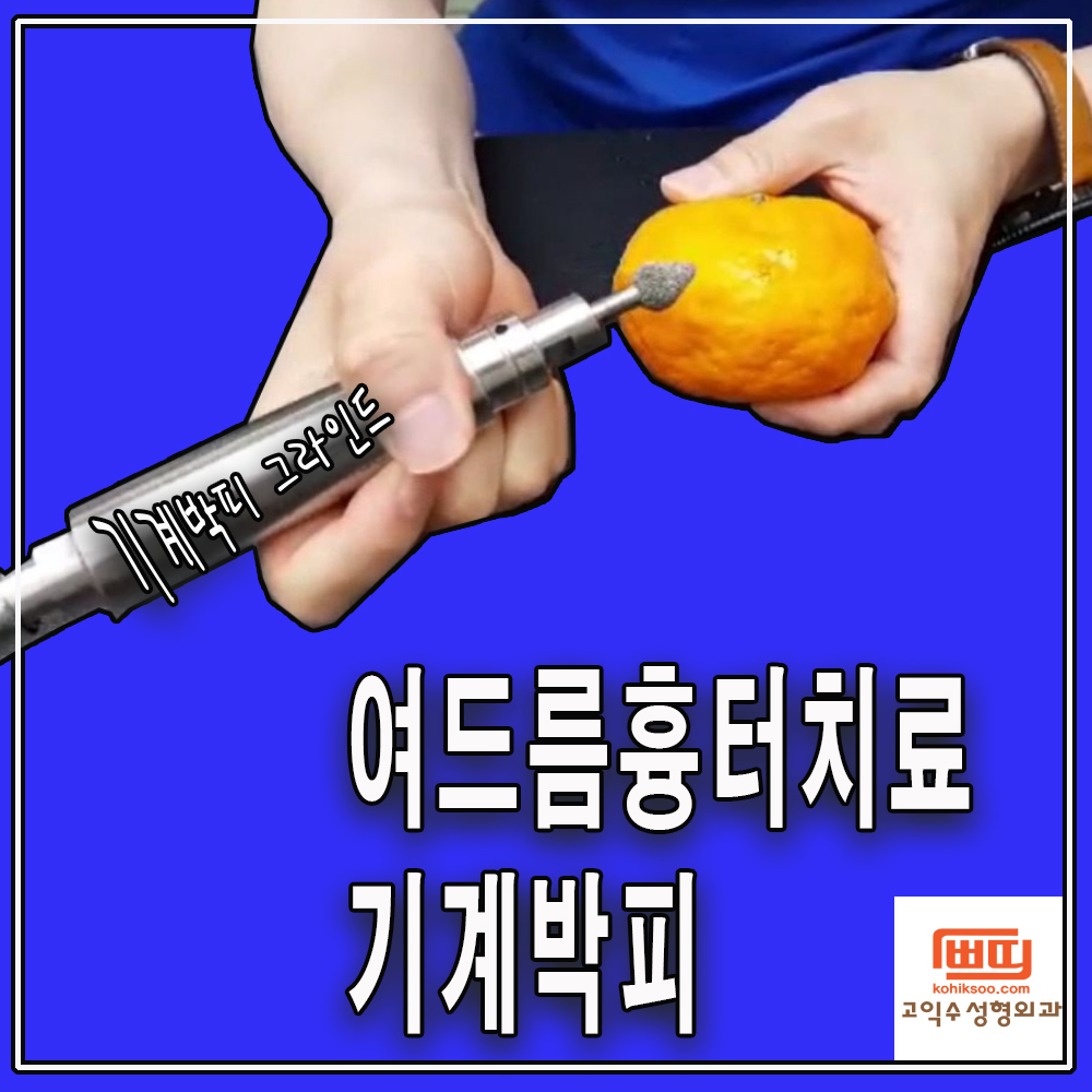 고익수성형외과의원 대표 이미지
