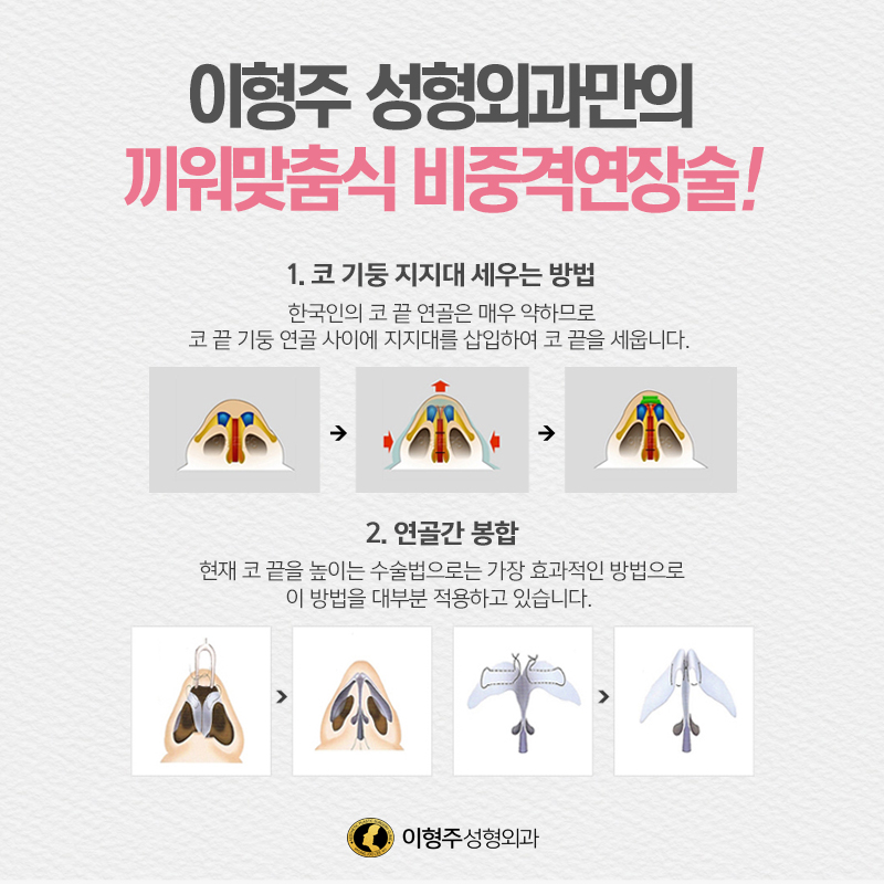 이형주성형외과의원 대표 이미지