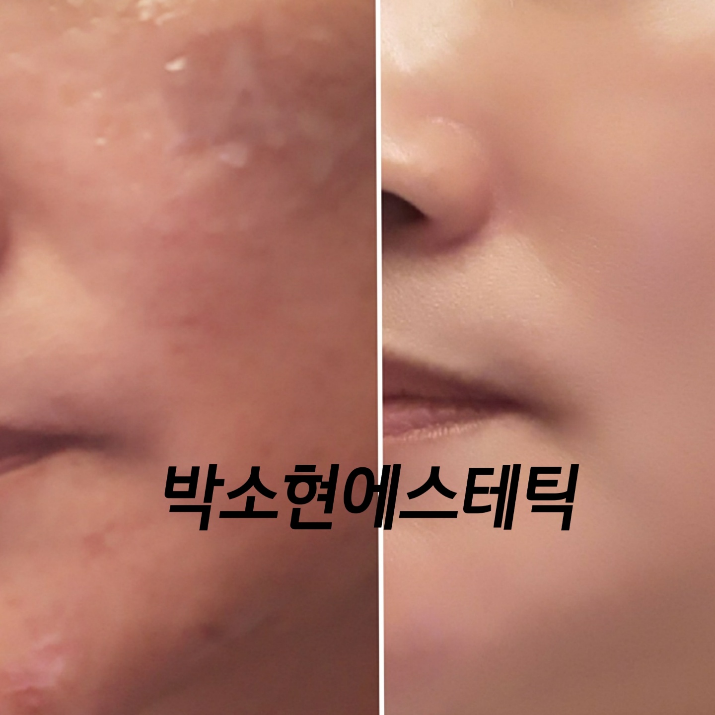 박소현에스테틱 세종본점