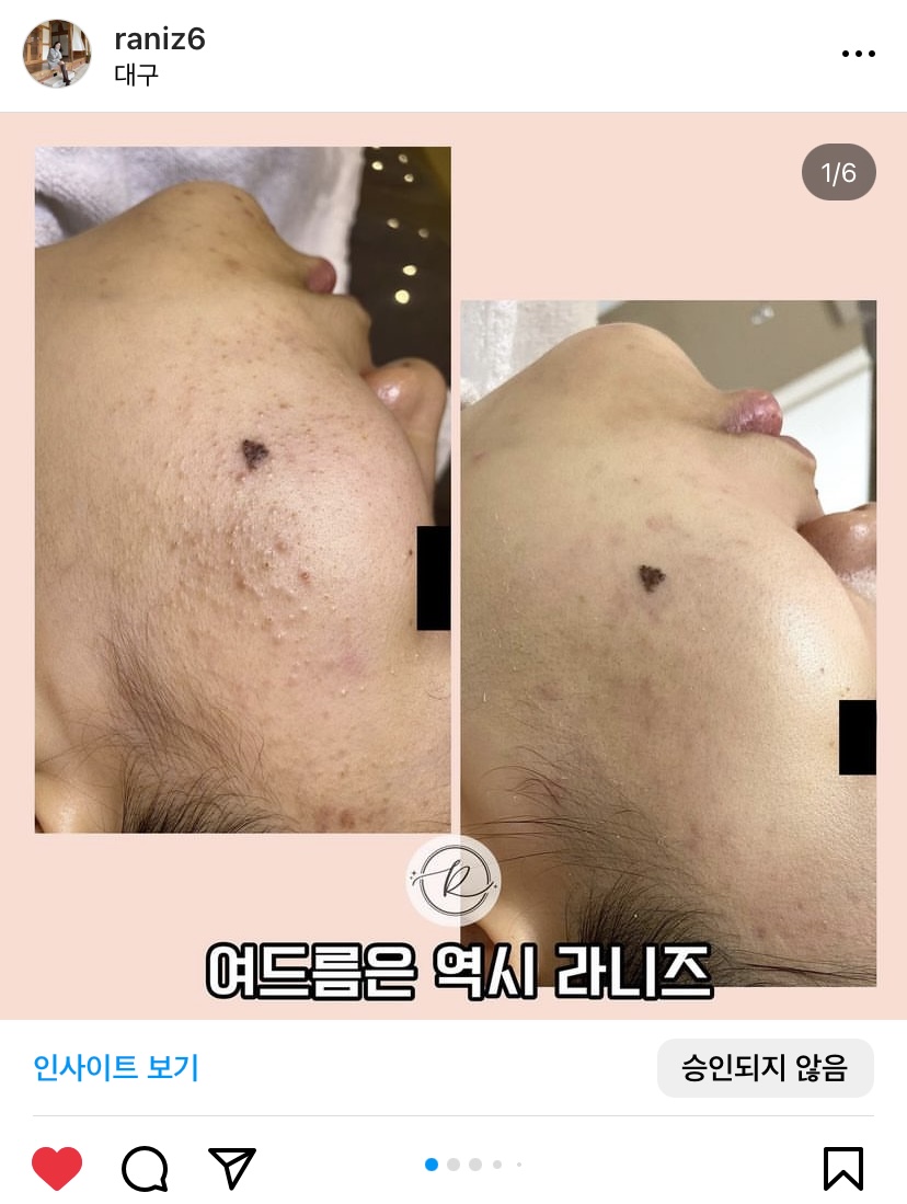 라니즈 대표 이미지