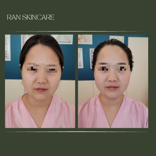 부천중동 란스킨케어