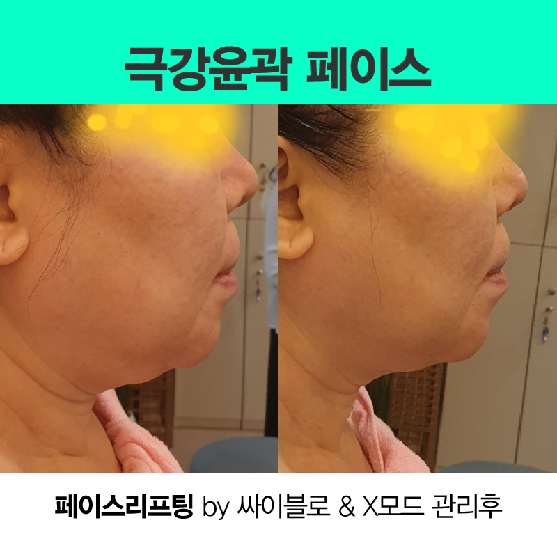 미즈고데이스파 대표 이미지