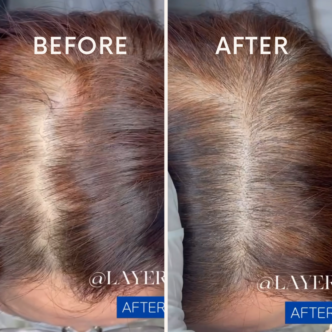 레이어에스엠피 대표 이미지