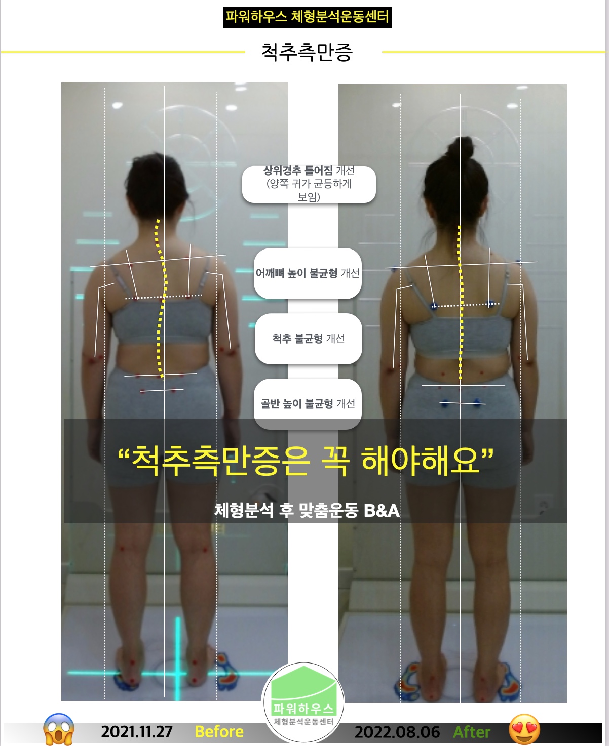 파워하우스 체형교정 필라테스 금호점 대표 이미지