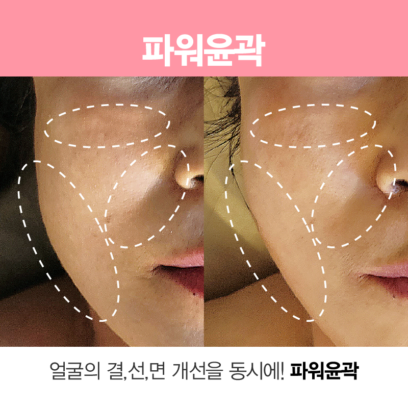 미즈고데이스파 대표 이미지