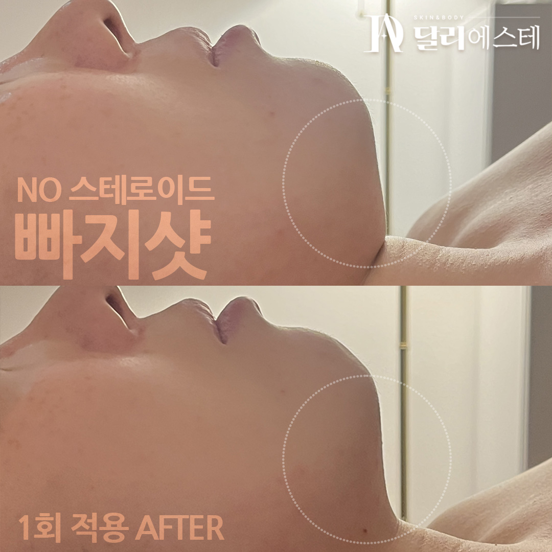 달리에스테 대표 이미지