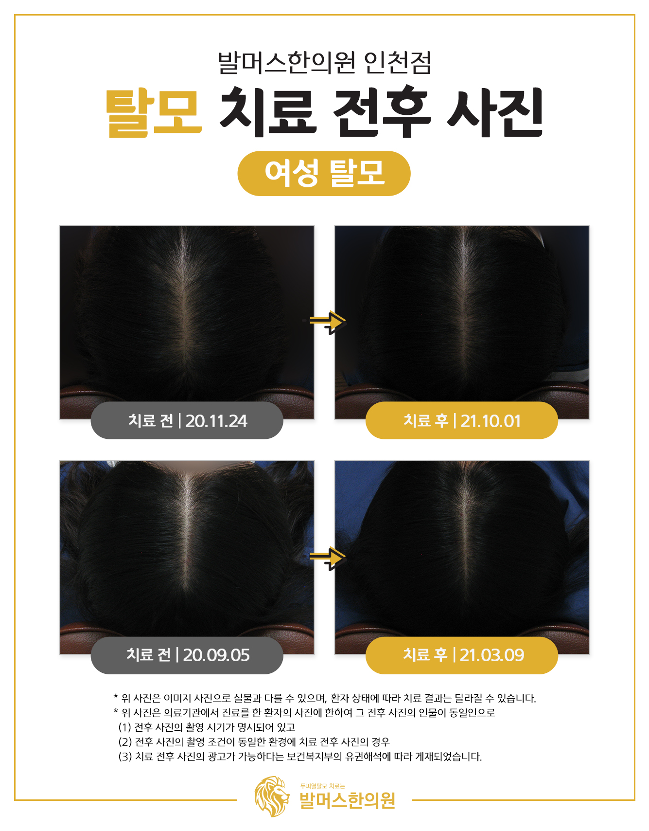 발머스한의원 대표 이미지