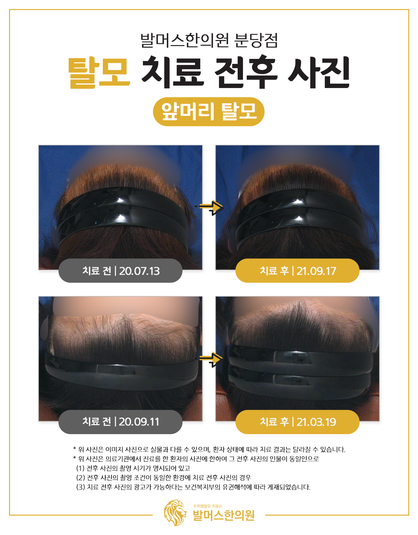 발머스한의원 분당 대표 이미지