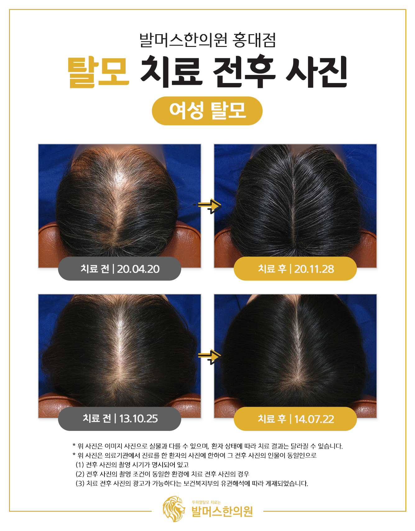 발머스한의원 일산