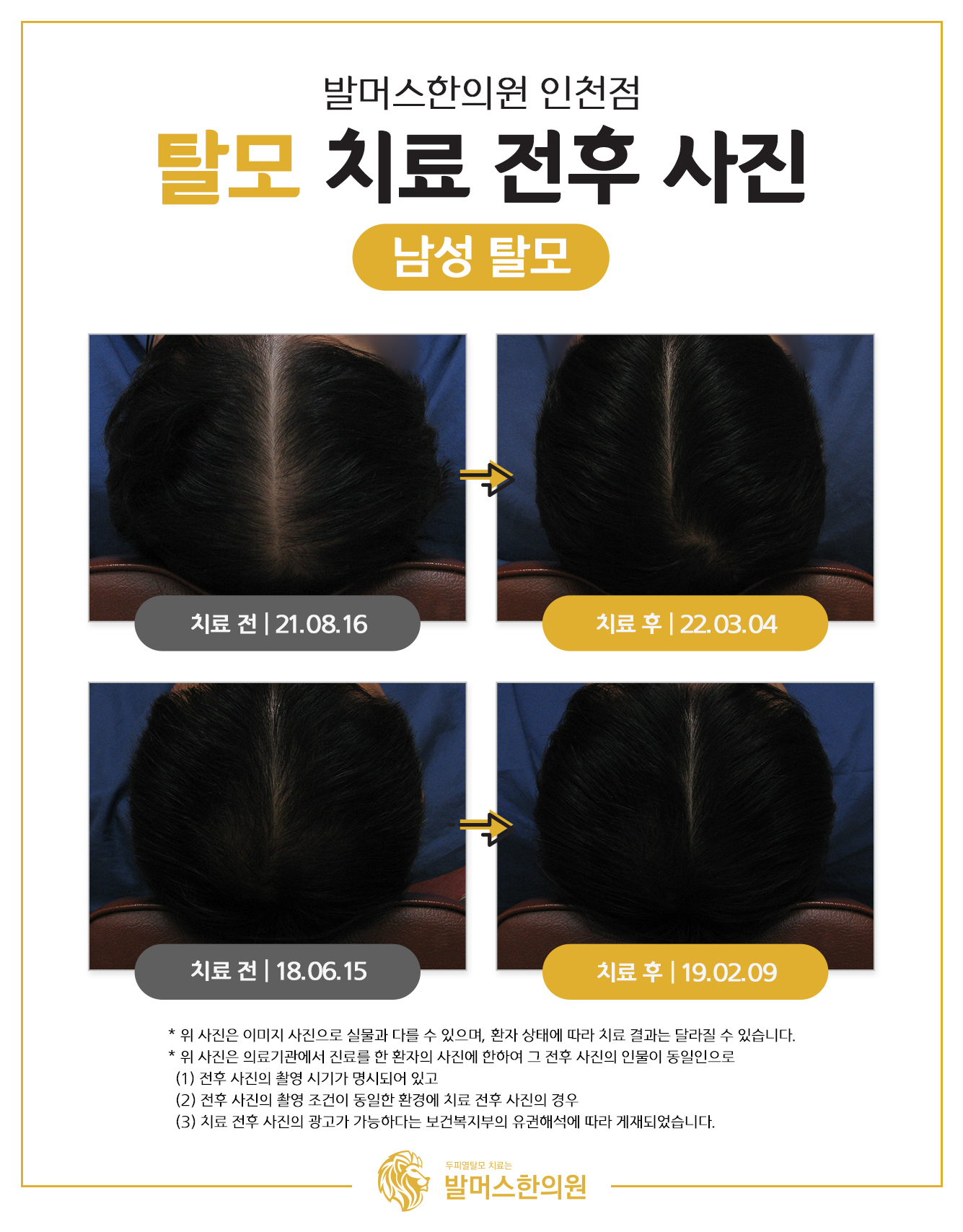 발머스한의원 대표 이미지