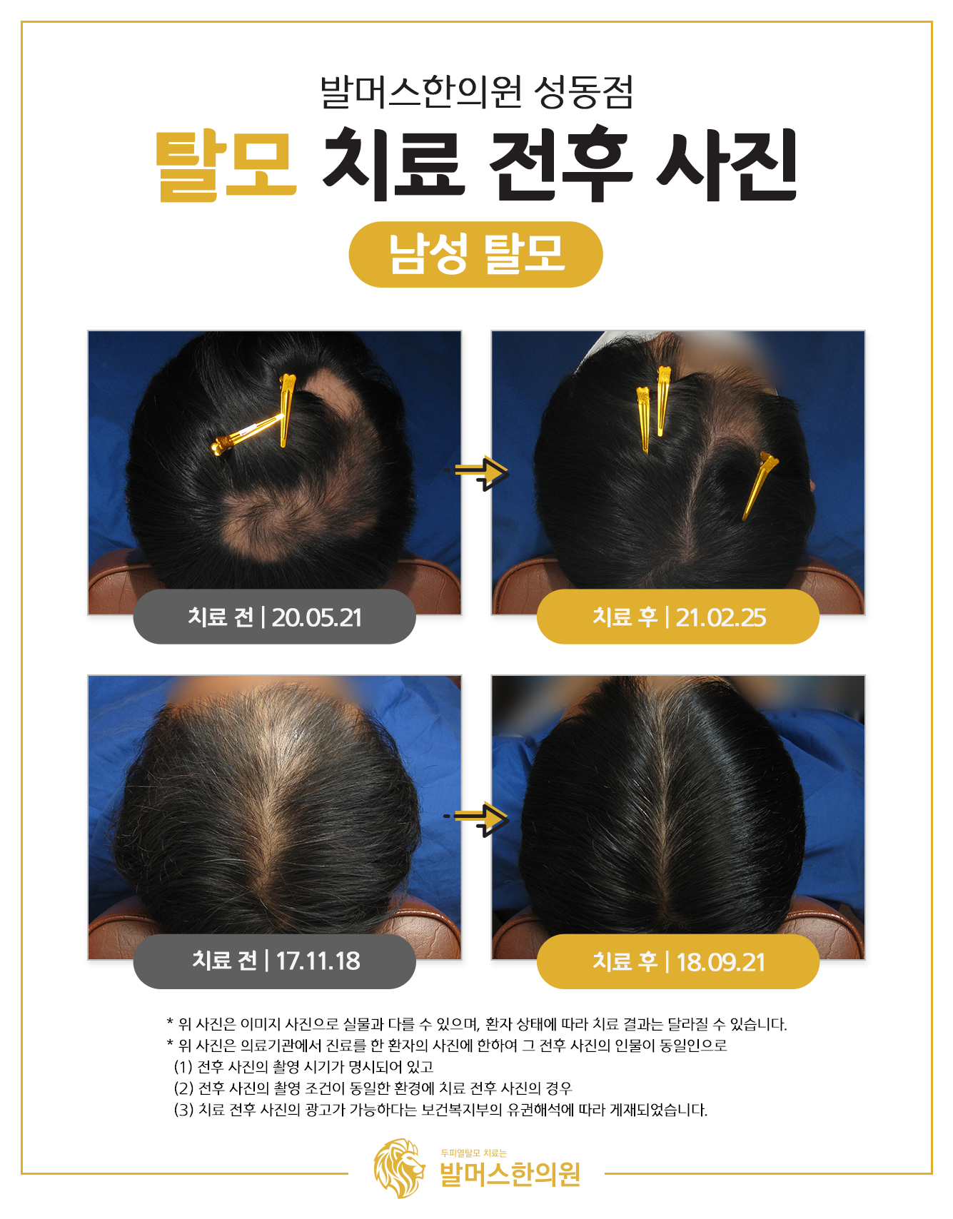 발머스한의원 종로성동 대표 이미지