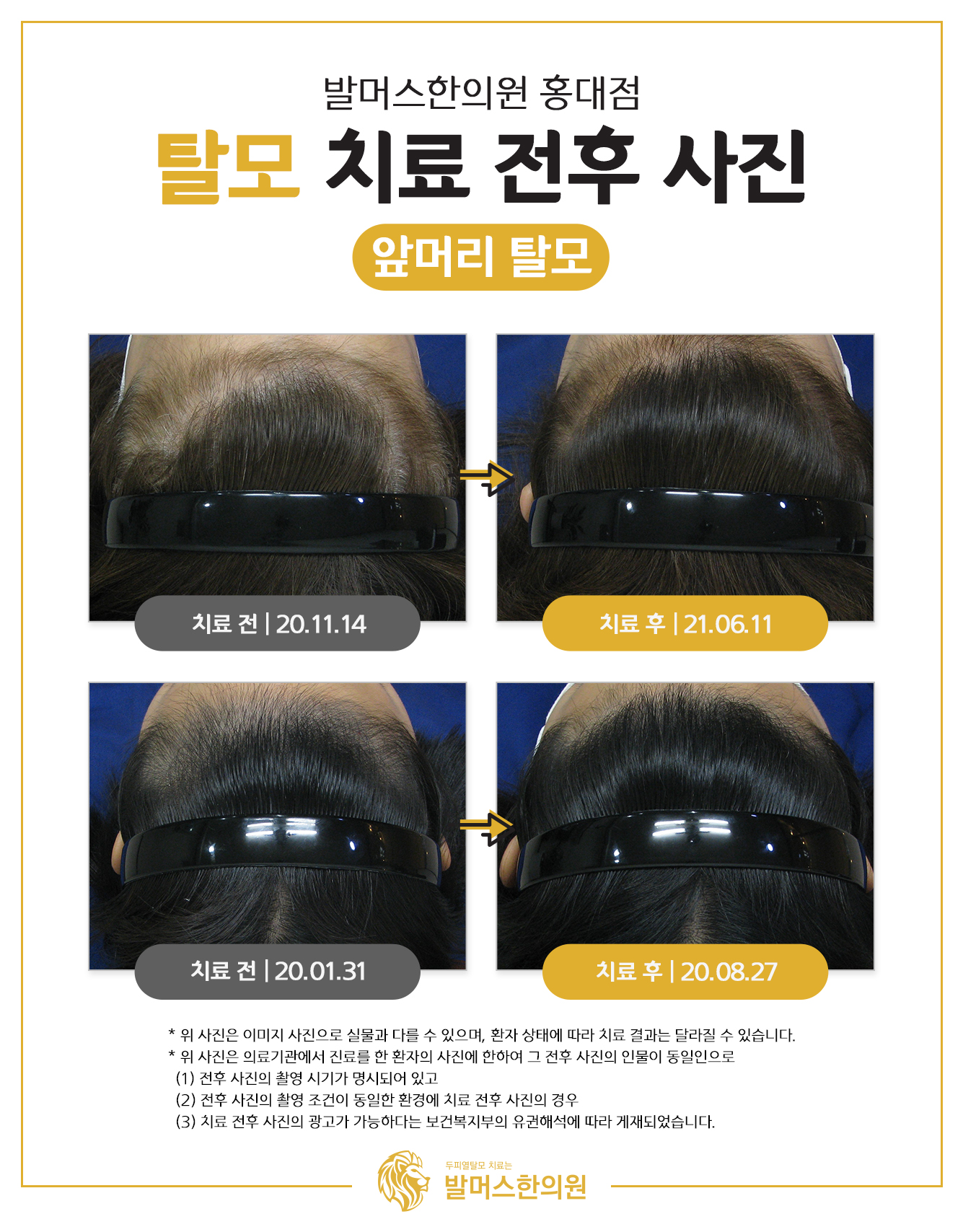 발머스한의원 홍대 대표 이미지