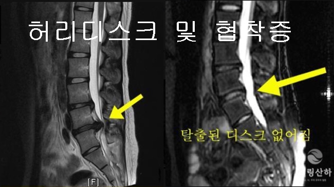 힐링산하 체형교정센터 대표 이미지