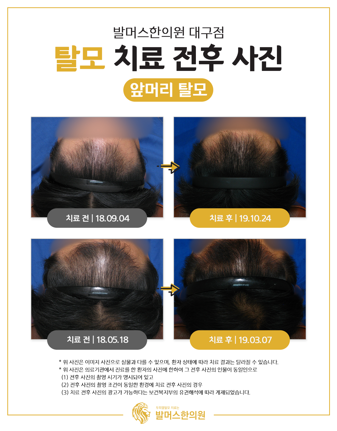 발머스한의원 대구 대표 이미지
