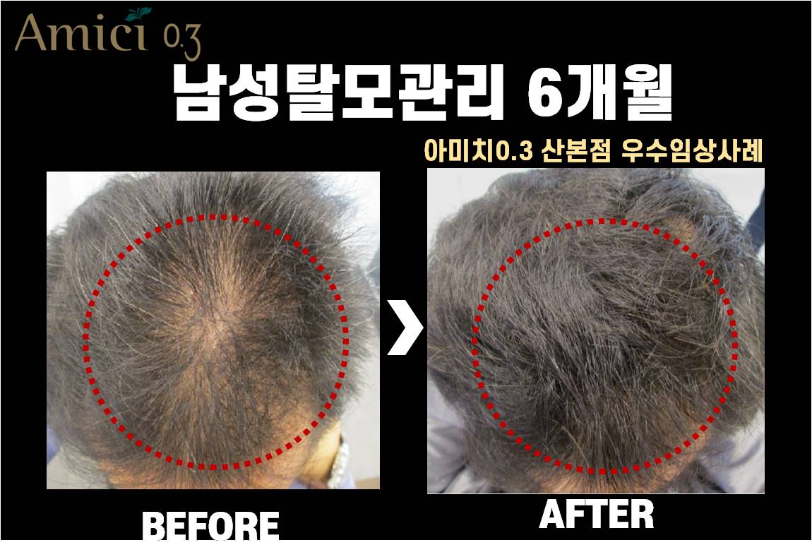 아미치0.3 산본점 대표 이미지