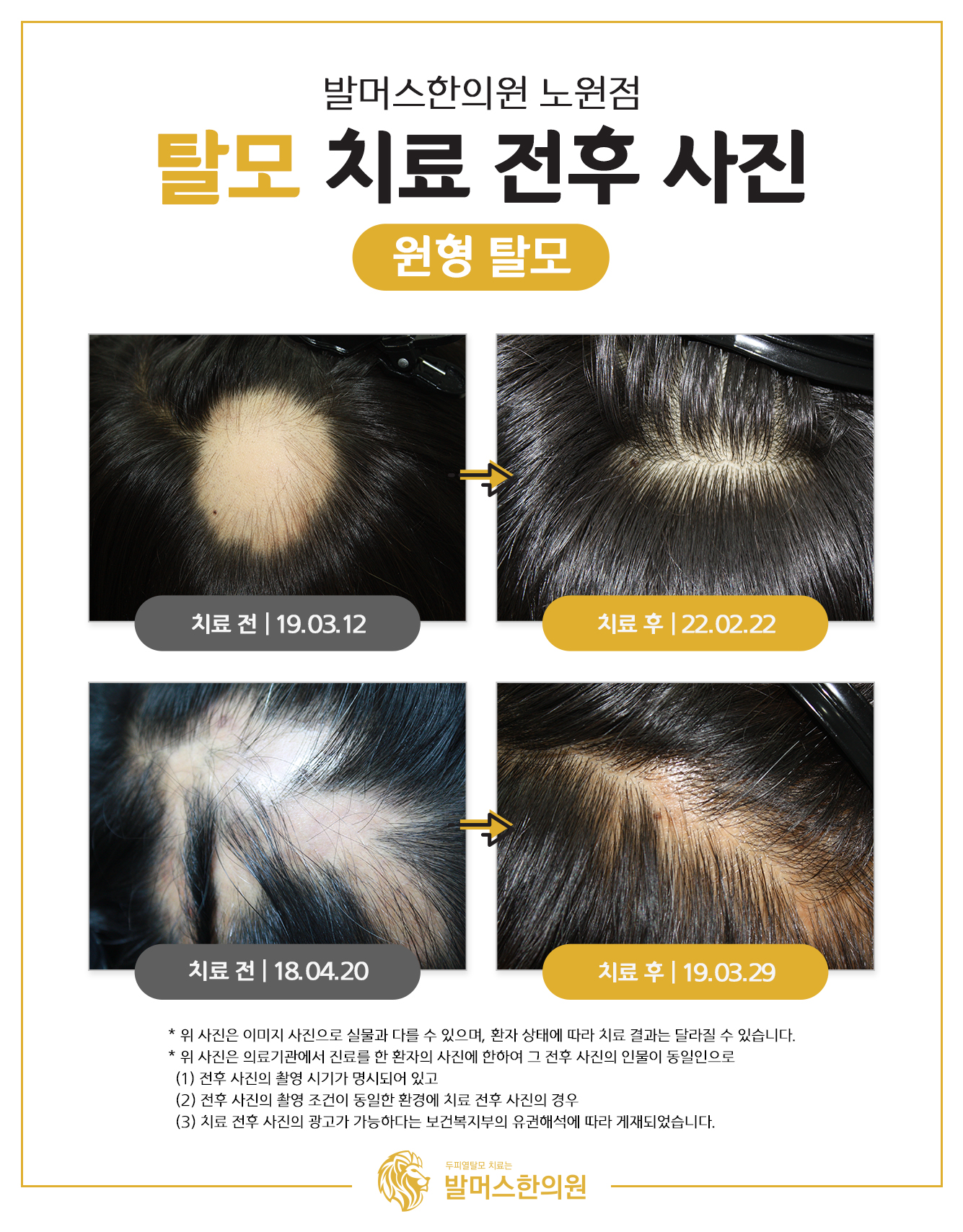 발머스한의원 노원 대표 이미지