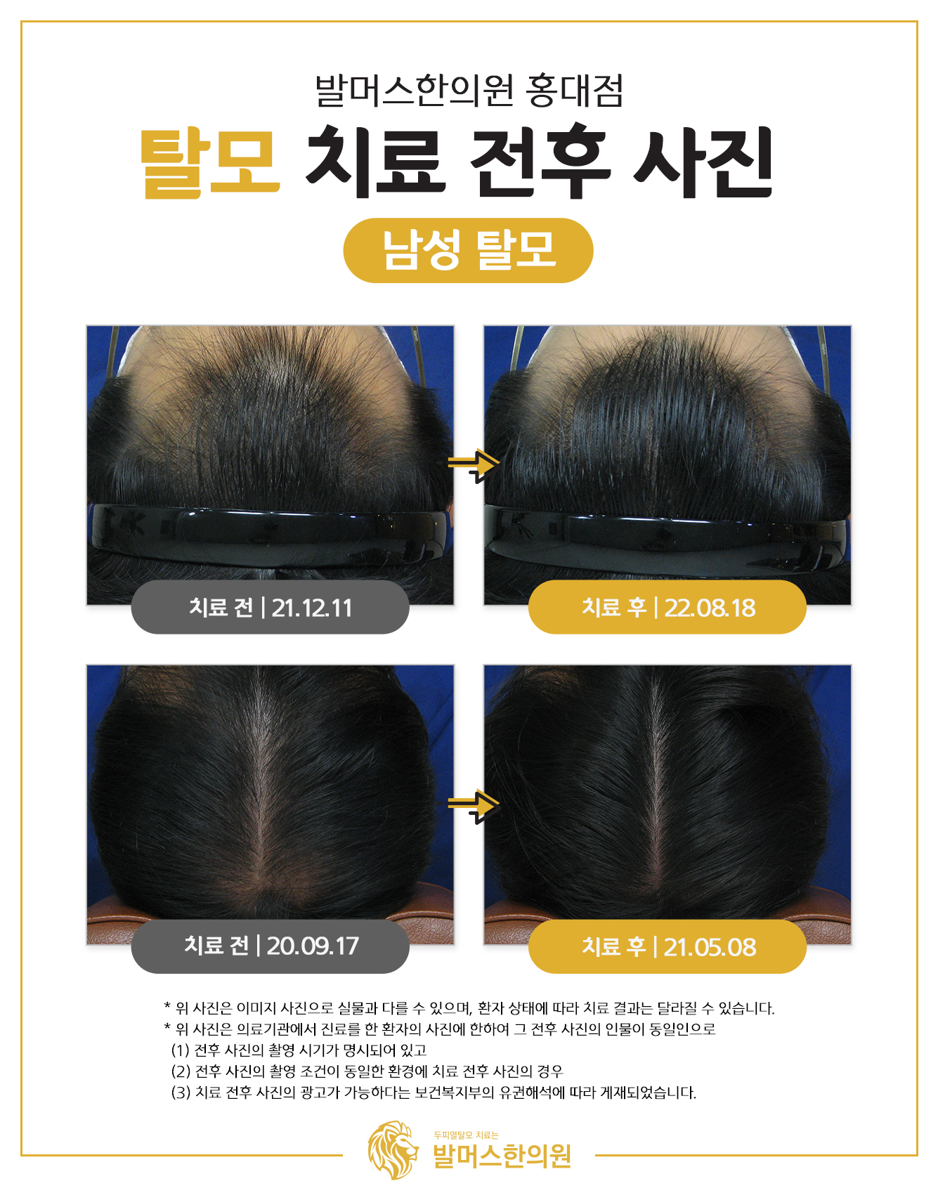 발머스한의원 홍대 대표 이미지