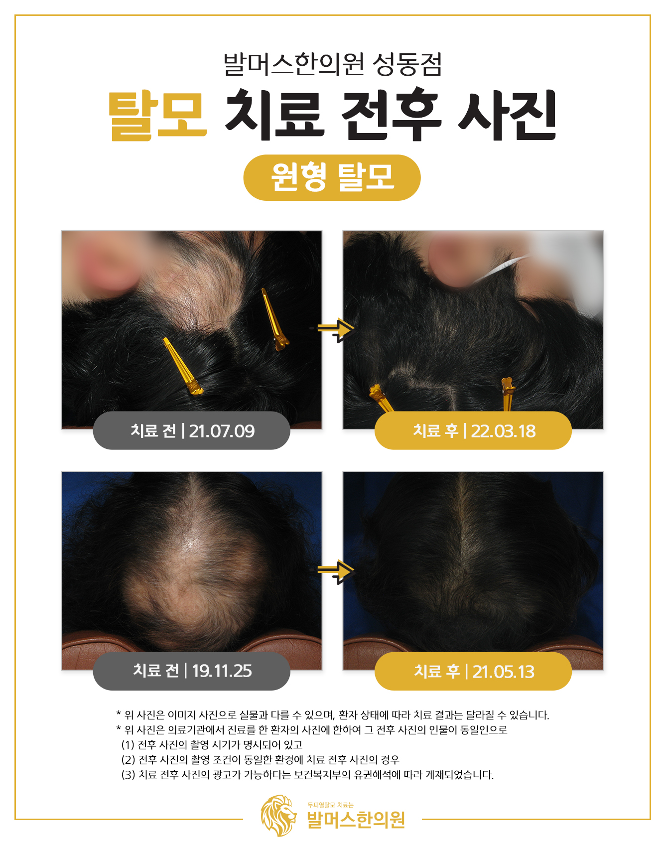 발머스한의원 대표 이미지