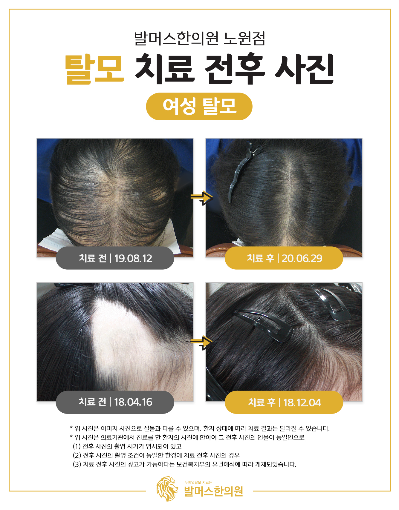 발머스한의원 노원 대표 이미지