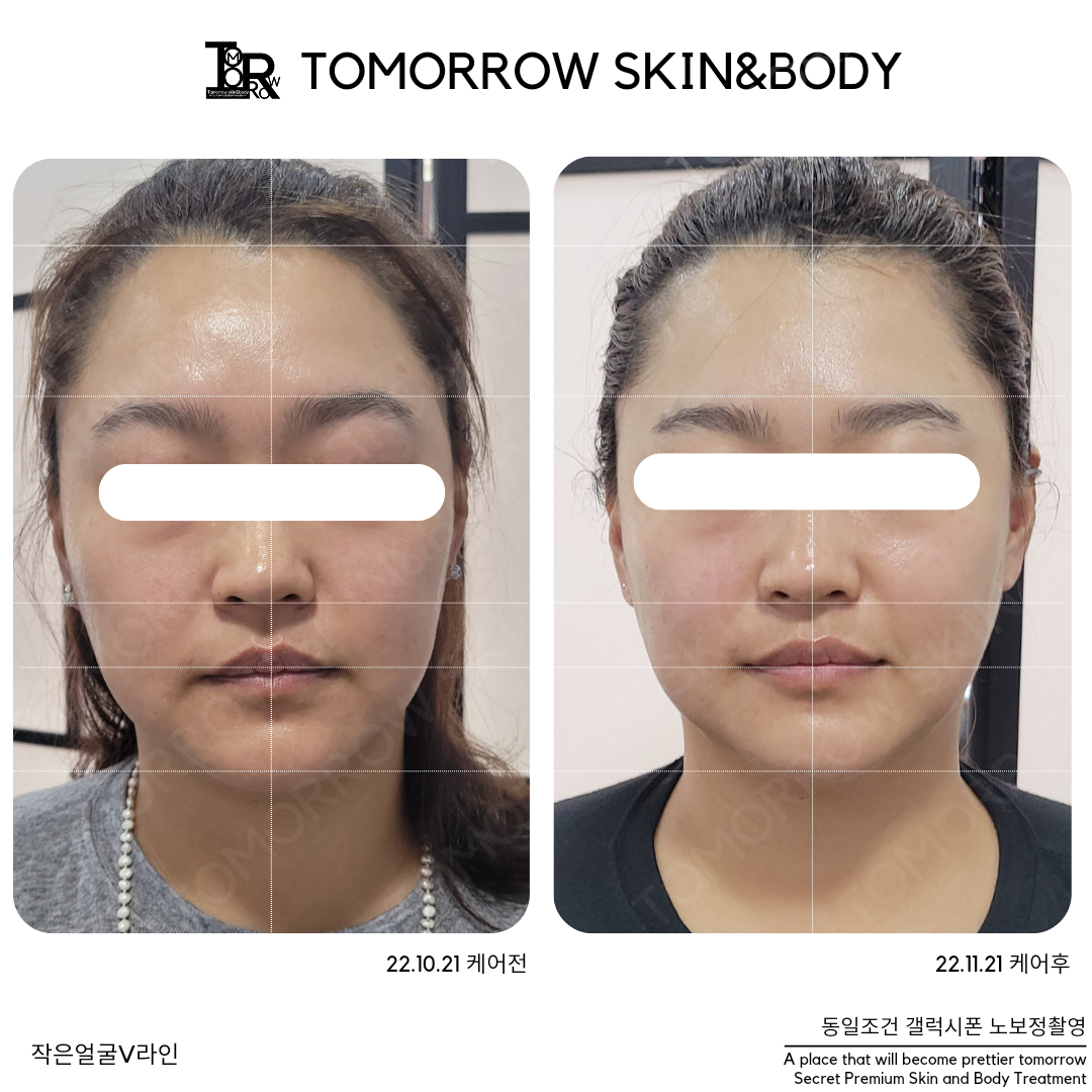 투모로우 스킨엔바디
