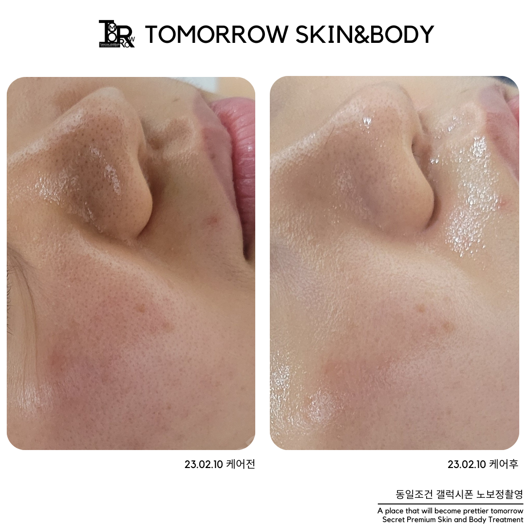 투모로우 스킨엔바디