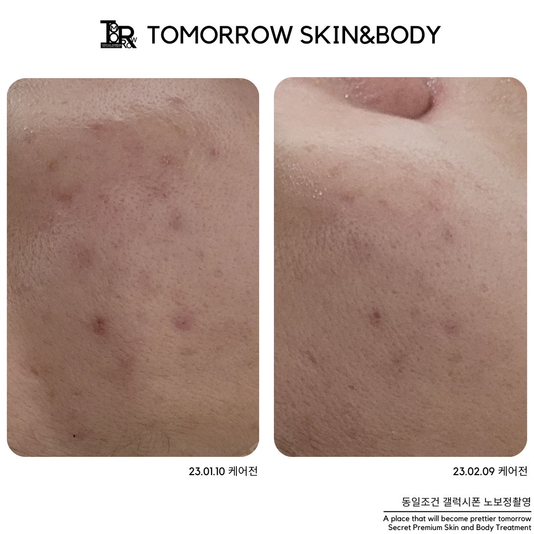 투모로우 스킨엔바디