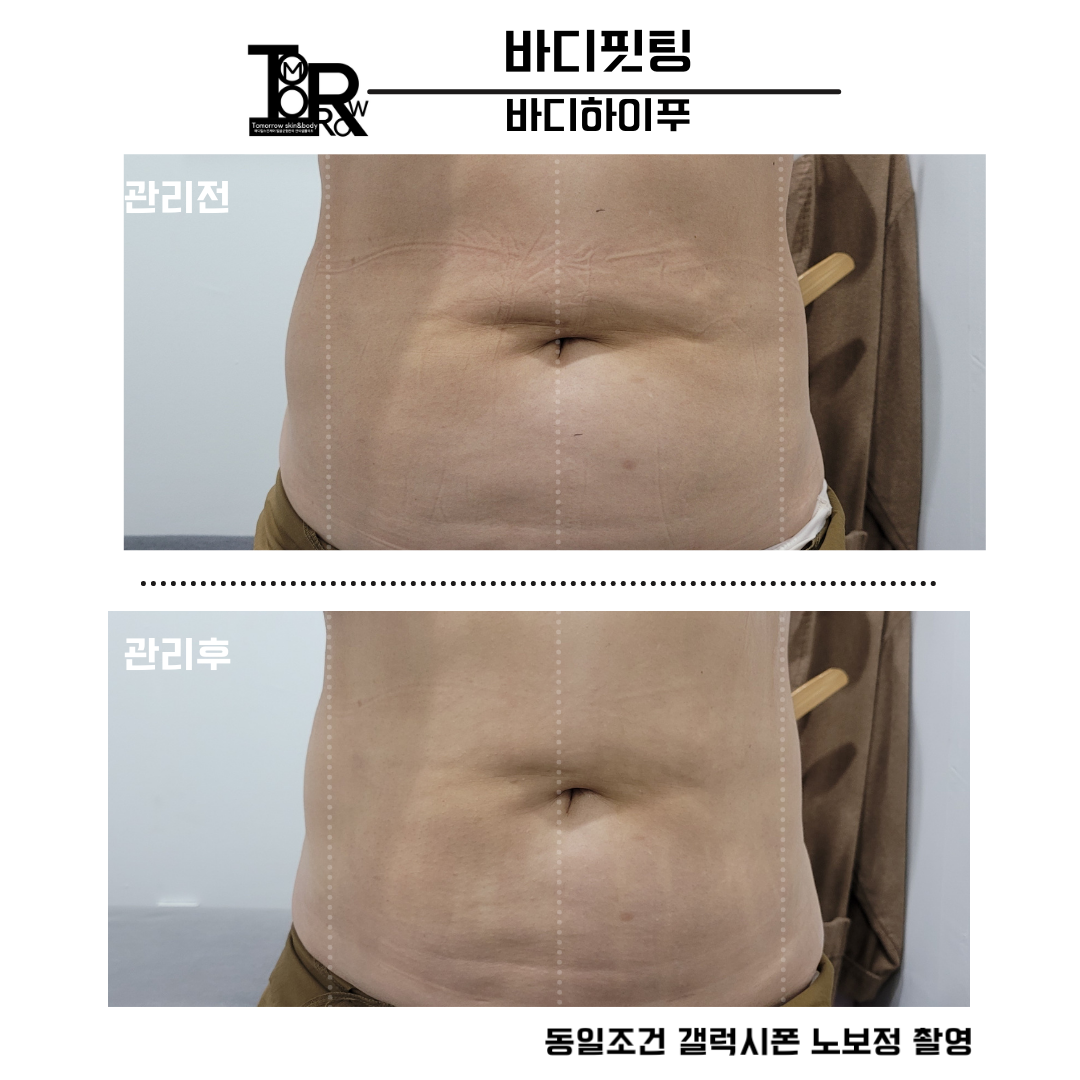 투모로우 스킨엔바디