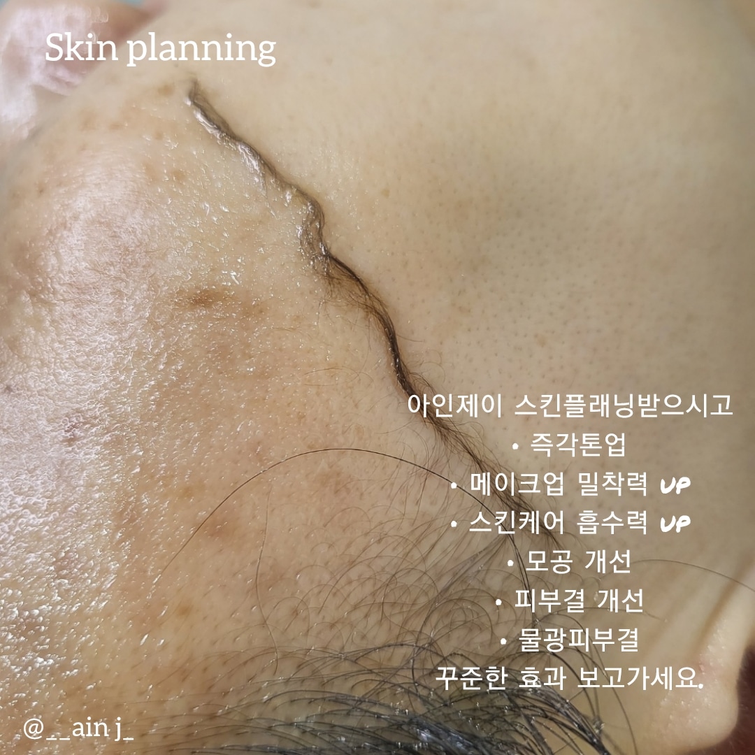 아인제이