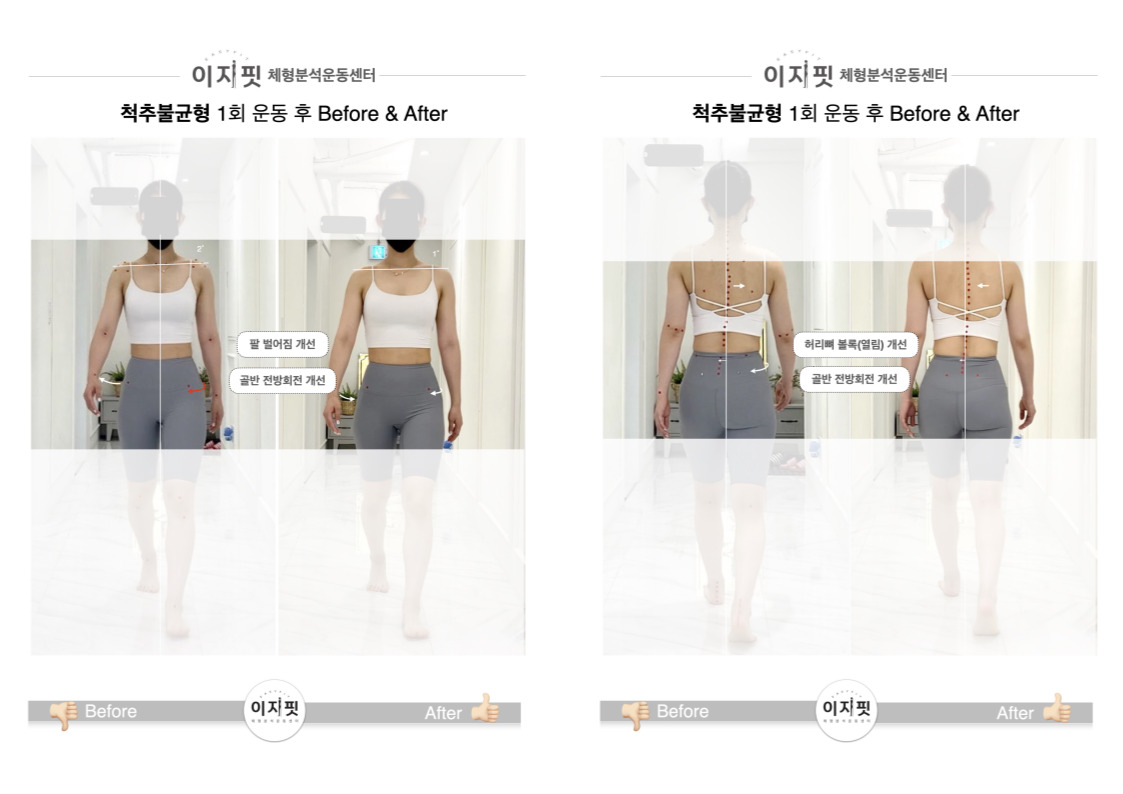 이지핏체형분석운동센터 대표 이미지