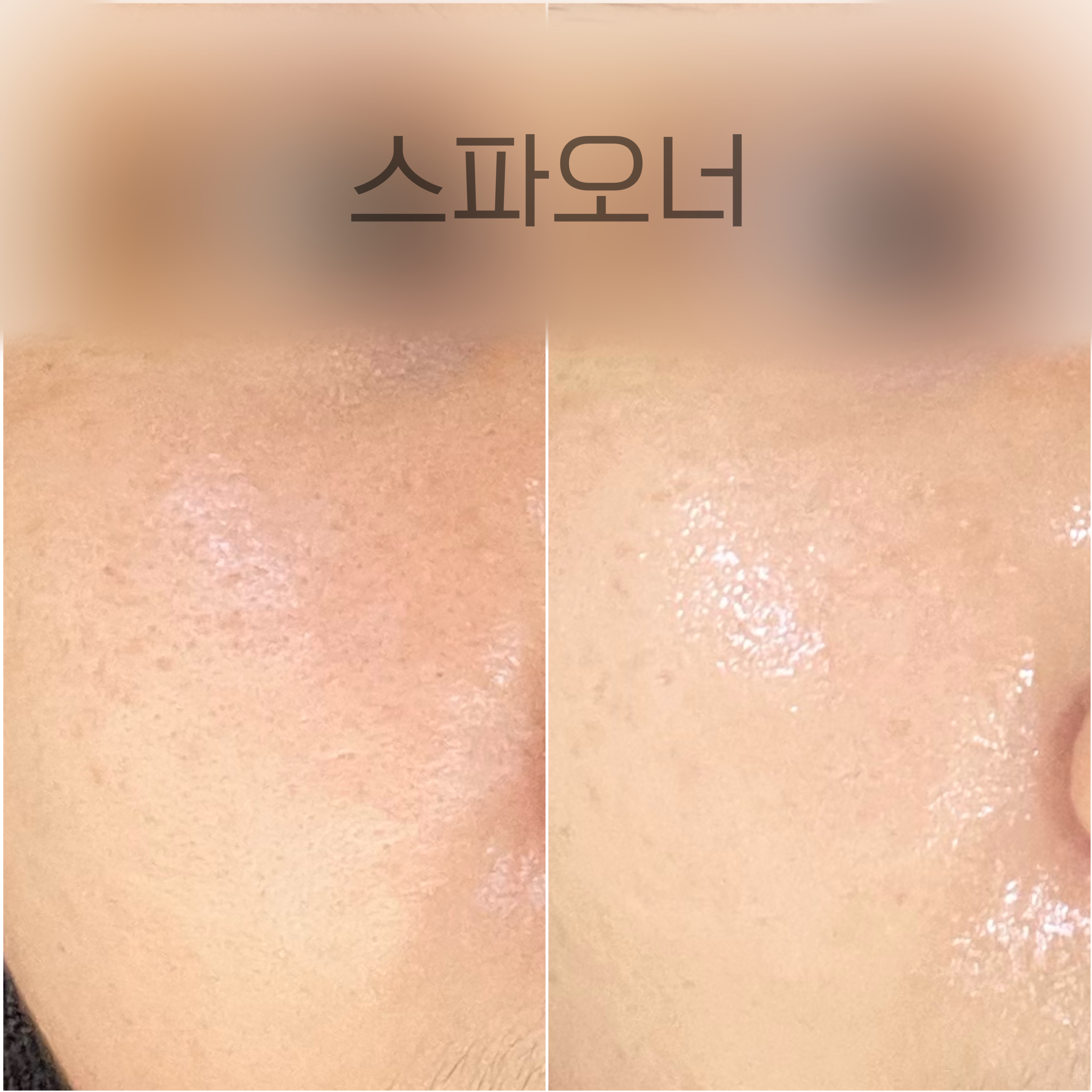 귀네테르 스파오너 이미지