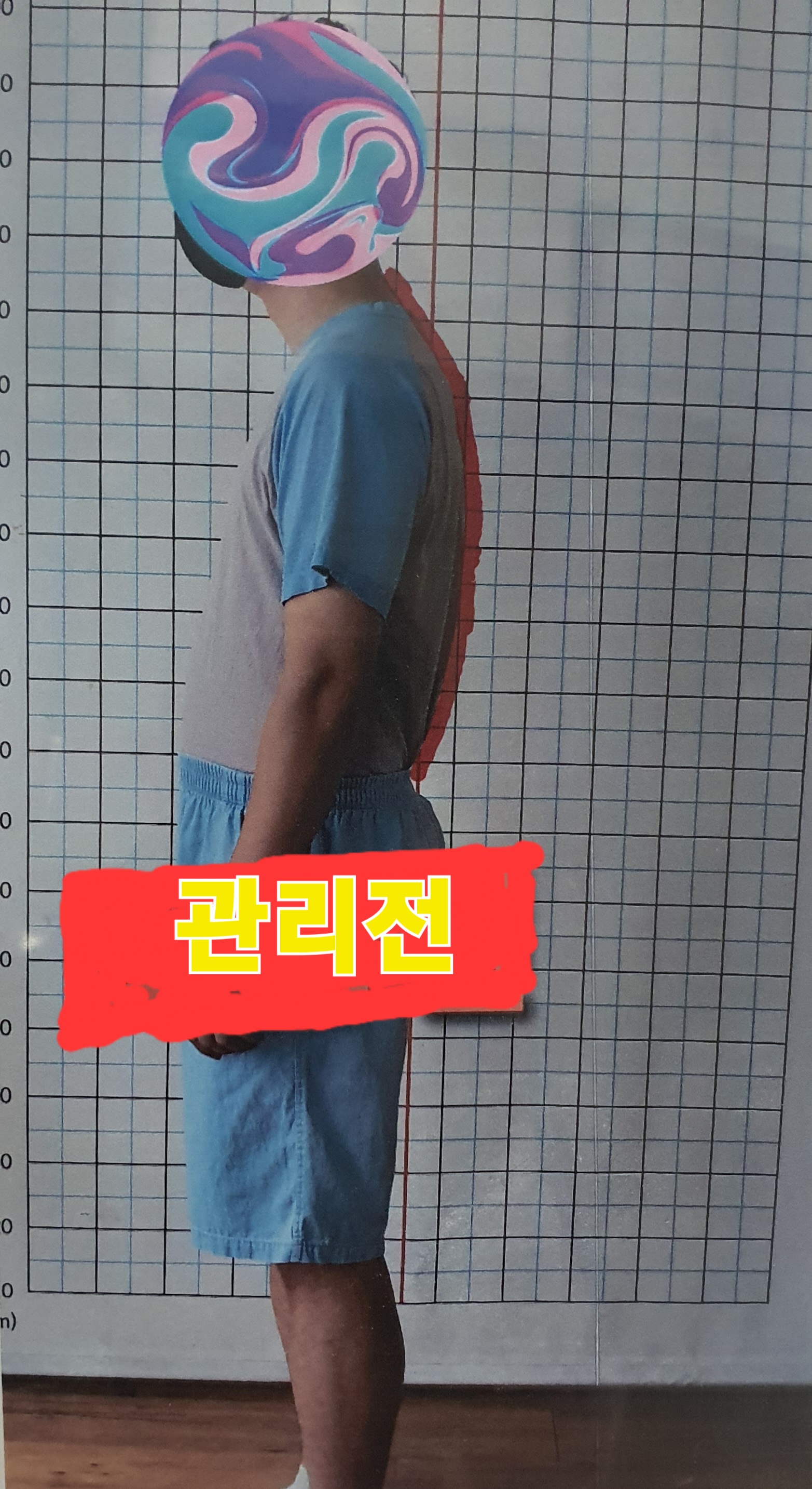 주약손체형교정명가