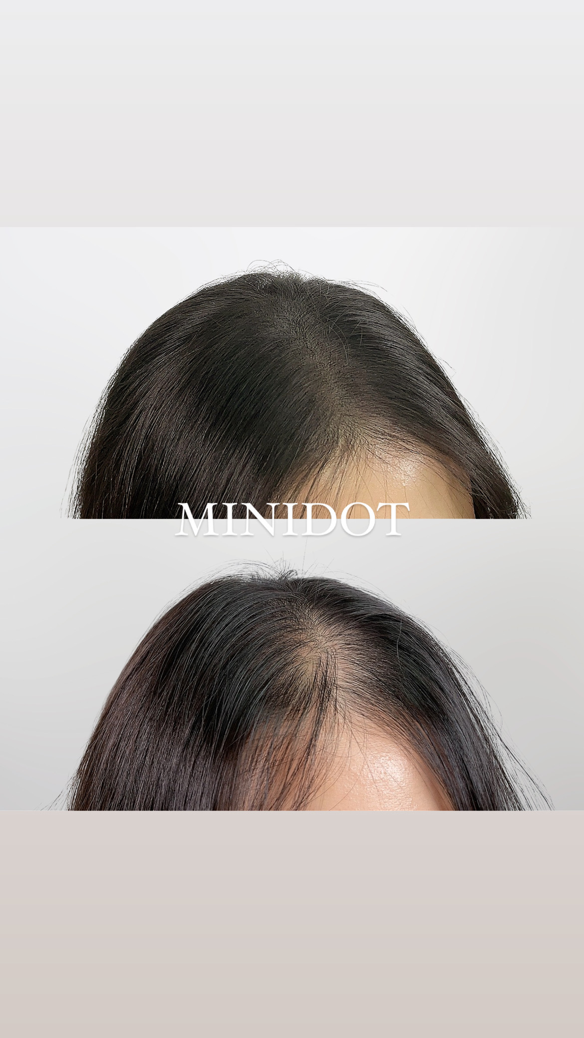 미니도트 대표 이미지