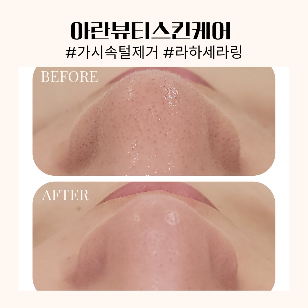 아란뷰티스킨케어 분당 야탑점