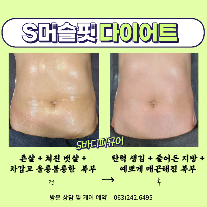 S바디피규어 피부 체형관리 photo 8