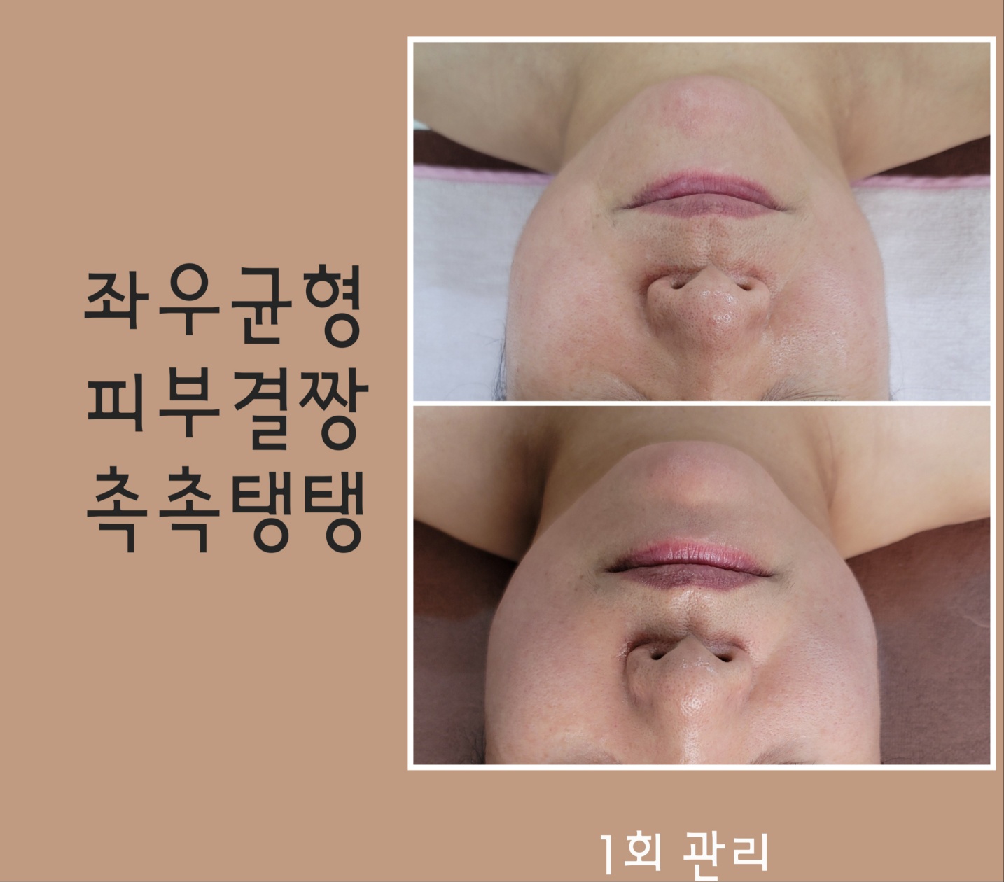 순스킨케어 대표 이미지