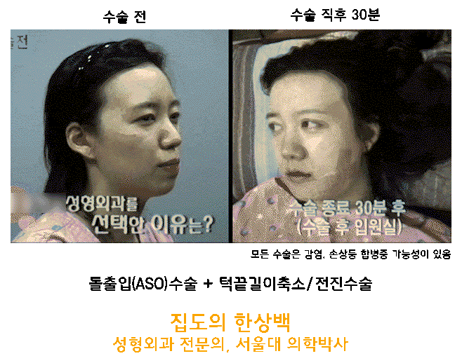 서울제일성형외과 대표 이미지