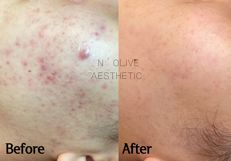 앤올리브에스테틱 대표 이미지