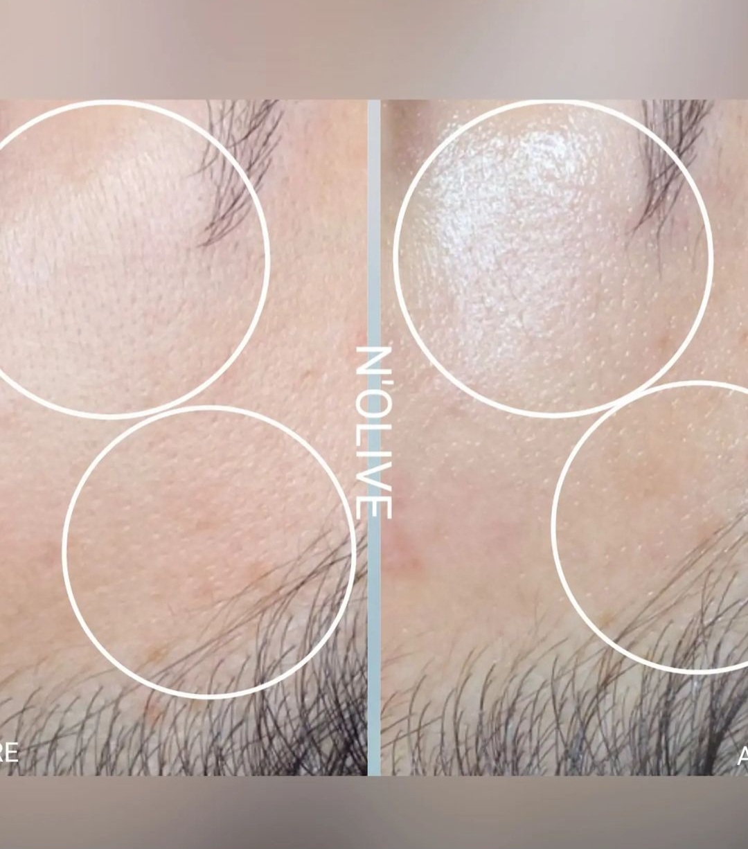 앤올리브에스테틱 대표 이미지