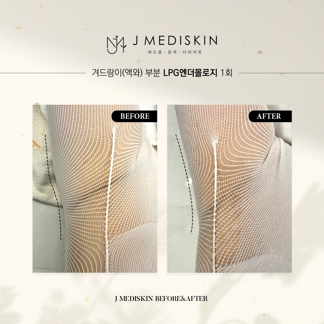 제이메디스킨